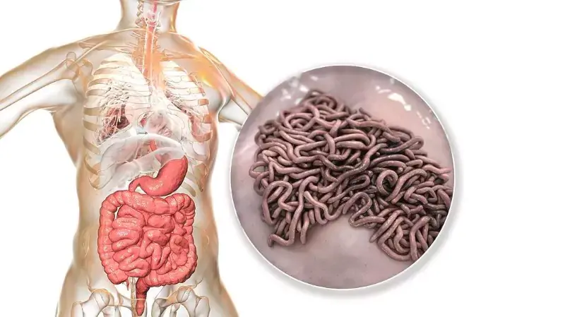 parasite treatment for humans guide